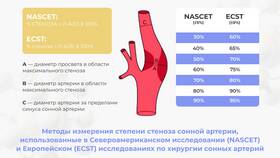 Бляшка 30 процентов: что делать в Центр Обувь